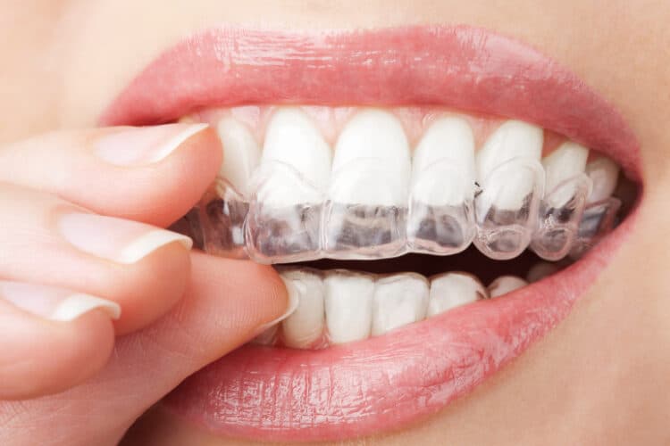 Moreland Neighborhood Dental